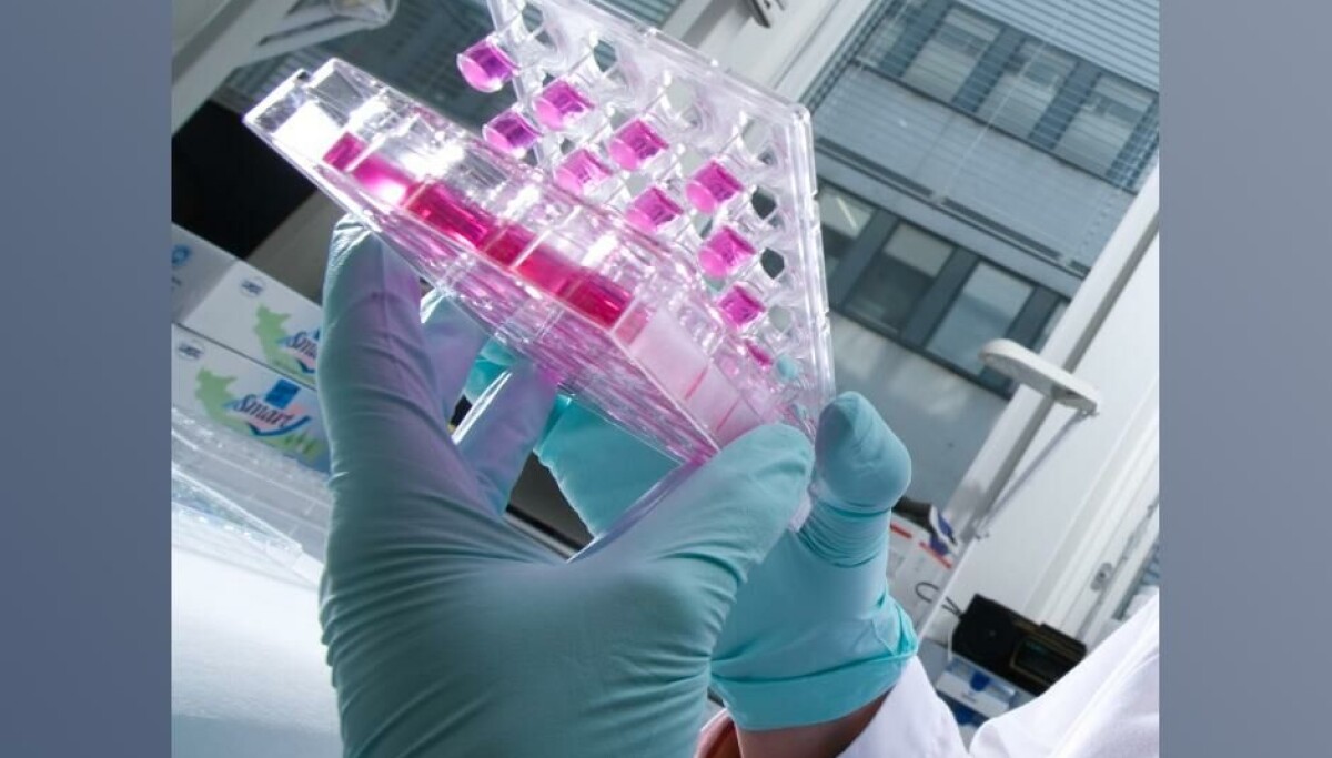 Polyphor Roche erwirbt Lizenz von Polyphor für Wirkstoff gegen Pseudomonas